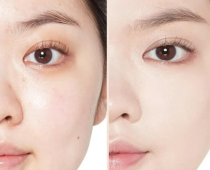 7 Dấu Hiệu Lão Hóa Da Thường Gặp Và Cách Chăm Sóc Da Đúng Cách