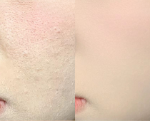 Makeup Mốc Nền Là Do Đâu? Bí Quyết Để Lớp Nền Mịn Như Filter