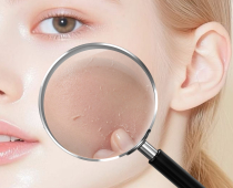 Lớp sừng trên da là gì? Lý do skincare không thấm vào da