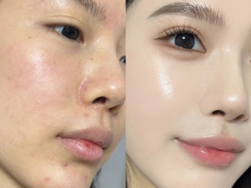 Mỹ Phẩm Chăm Sóc Da Cao Cấp Cho Lộ Trình Chăm Da Đếm Ngược Tới Tết