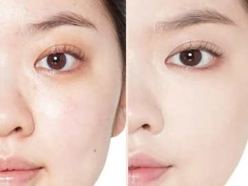 7 Dấu Hiệu Lão Hóa Da Thường Gặp Và Cách Chăm Sóc Da Đúng Cách