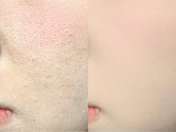 Makeup Mốc Nền Là Do Đâu? Bí Quyết Để Lớp Nền Mịn Như Filter