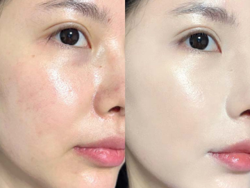 Dưỡng Trắng Da Mặt​ Ngay Nếu Không Muốn Da Xuống Sắc Dịp Tết