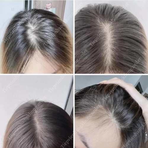 Viên Uống Hair Probiotic CodeAge Hộp 120 Viên