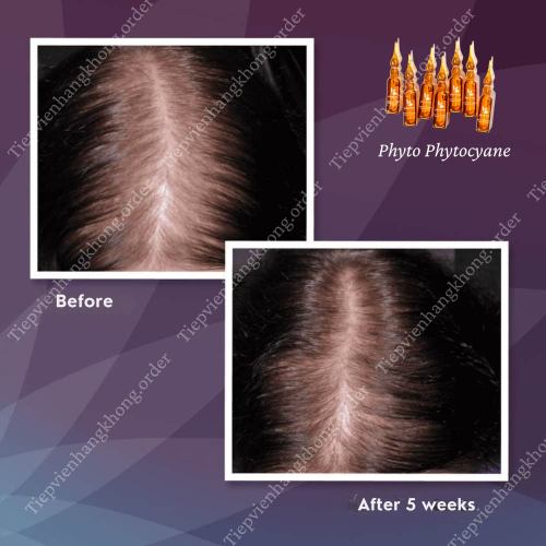 Serum Ngăn Rụng & Kích Thích Mọc Tóc Phyto Phytocyane Tím 12 Ống x 7.5ml