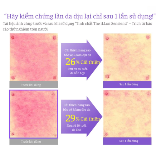 Combo THE iLLON Sensiend Ampoule + Post Protective Soothing Mask – Làm Dịu Chuyên Sâu, Cấp Ẩm Và Phục Hồi Da