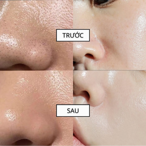 Bột Rửa Mặt The iLLON Danggi Enzyme Powder Wash – Làm Sạch Sâu, Tẩy Tế Bào Chết Dịu Nhẹ Và Duy Trì Độ Ẩm Cho Da