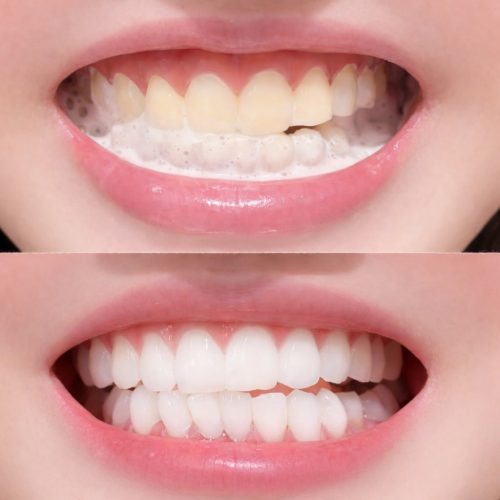 Combo Kem Đánh Răng Marvis Whitening Mint + Nước Súc Miệng Marvis – Làm Sạch Khoang Miệng, Thơm Mát Và Tự Tin Hơn Mỗi Ngày