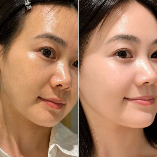  IL09 The iLLON melagen ampoule - Tinh chất cải thiện sắc tố da - 50ml (Tặng kem dưỡng full & mặt nạ phục hồi)