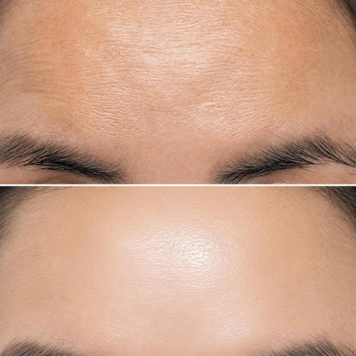 Murad Retinal ReSculpt Overnight Treatment 30ml – Tinh chất Retinal nâng cơ, giảm nhăn chuyên sâu