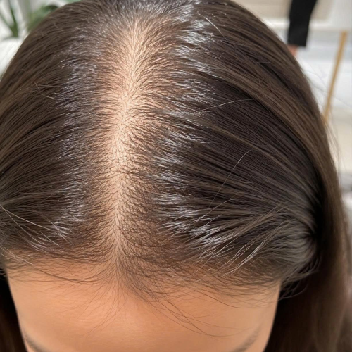 Viên Uống Codeage Hair Vitamins 120 Viên – Hỗ Trợ Giảm Gãy Rụng, Nuôi Dưỡng Tóc Chắc Khỏe Từ Bên Trong