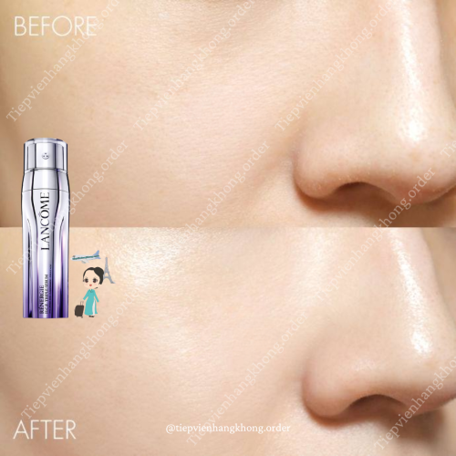 Serum Lancôme 50Ml Chai Tím