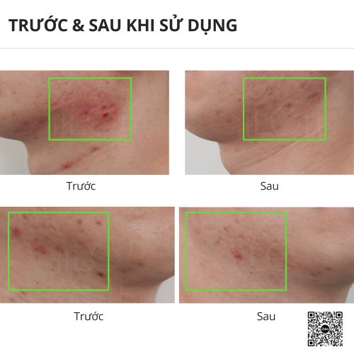 Bộ Chăm Sóc Da 3 Bước Chuyên Sâu The iLLon Actune Kit 