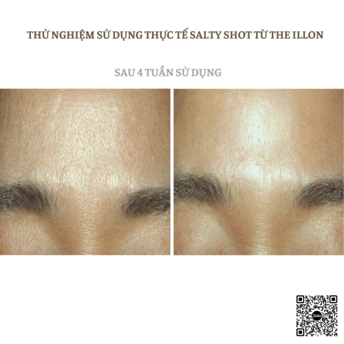 Mặt Nạ Giúp Da Khỏe Mạnh - The iLon Salty Shot