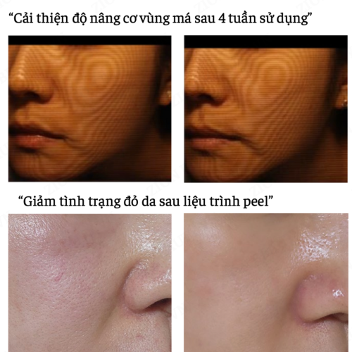 Mặt Nạ Làm Dịu - The ilLon Post Protective Soothing Mask