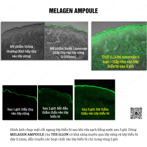 Tinh Chất Cải Thiện Sắc Tố Da - The ilLon Melagen Ampoule