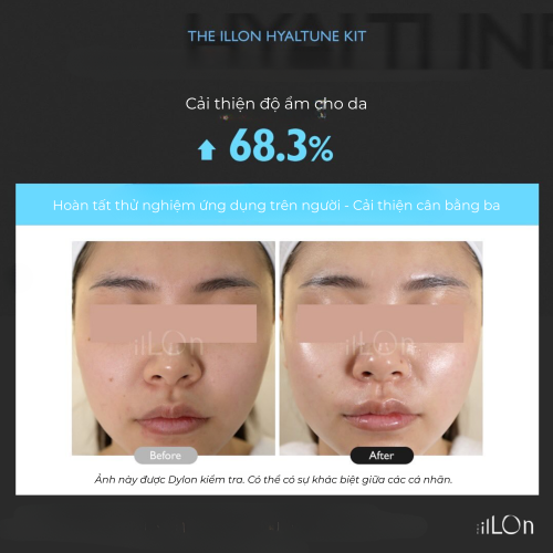 Bộ Peel Dưỡng Ẩm - The iLLon Hyaltune Kit