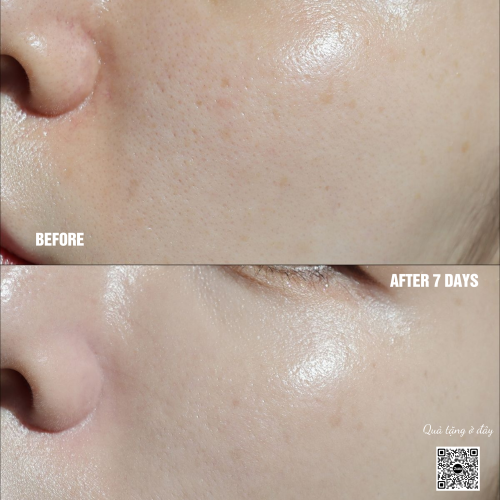 Kem Dưỡng Đêm Melagen Shot - The ILLon Melagen Shot Night Cream