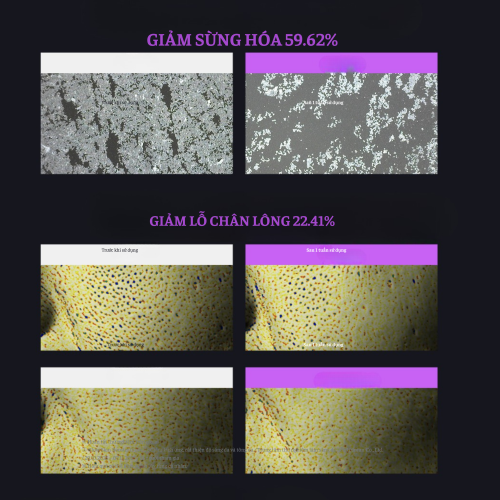 Peel Mờ Nám Cao Cấp The ILLon Melatune Kit