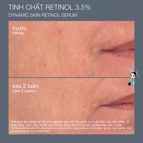 Serum Trẻ Hóa Da Dermalogica Dynamic Skin Retinol Serum