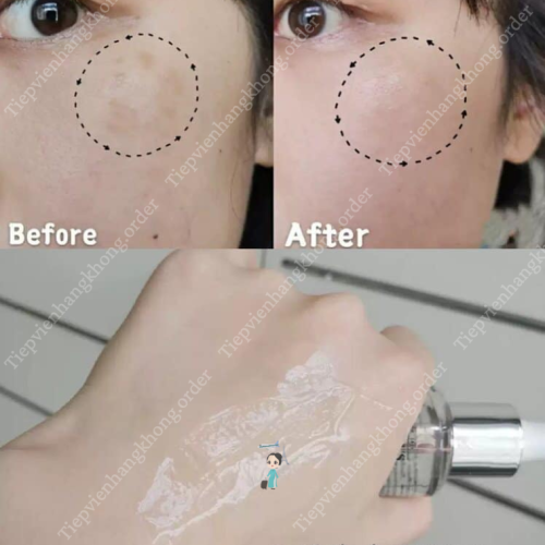 Serum Mờ Thâm Mụn & Đều Màu Da Kiehl’s Clearly Corrective Dark Spot 50ML