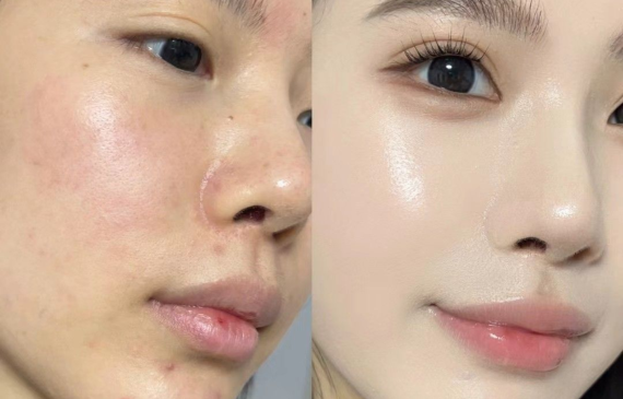 Mỹ Phẩm Chăm Sóc Da Cao Cấp Cho Lộ Trình Chăm Da Đếm Ngược Tới Tết