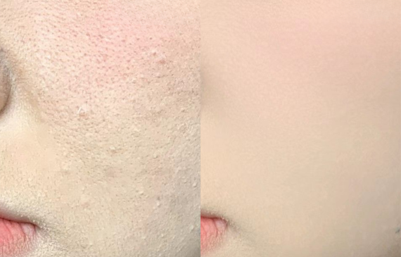 Makeup Mốc Nền Là Do Đâu? Bí Quyết Để Lớp Nền Mịn Như Filter