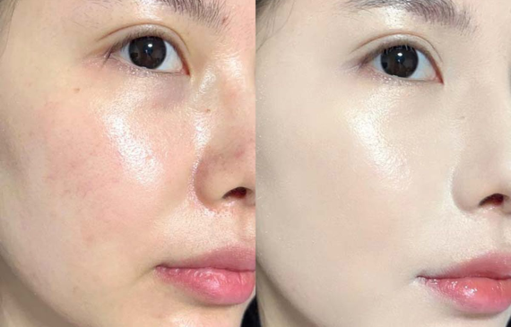 Dưỡng Trắng Da Mặt​ Ngay Nếu Không Muốn Da Xuống Sắc Dịp Tết