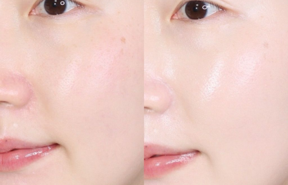 Chăm Sóc Da Mặt Đúng Cách​ Nhìn Da Biết Ngay