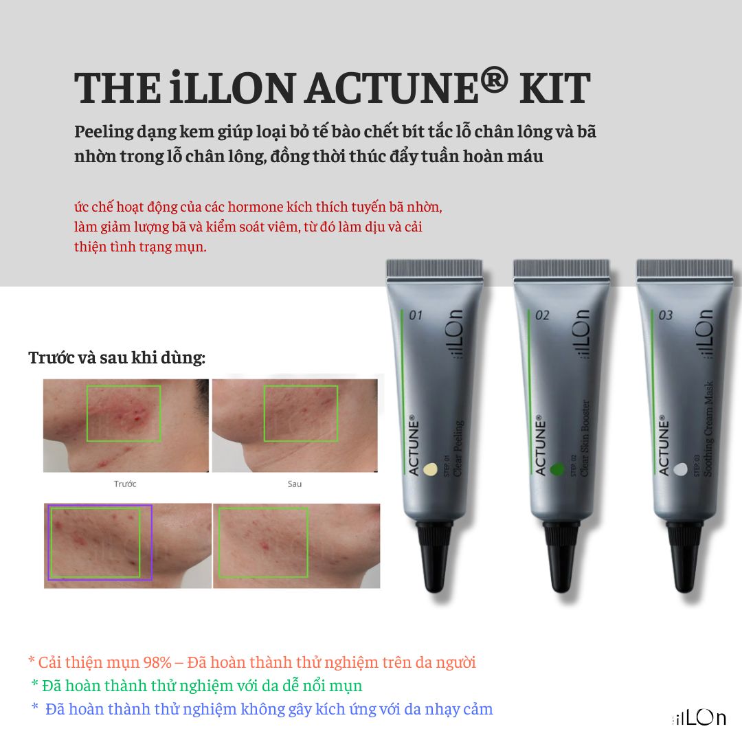 cách trị thâm mụn