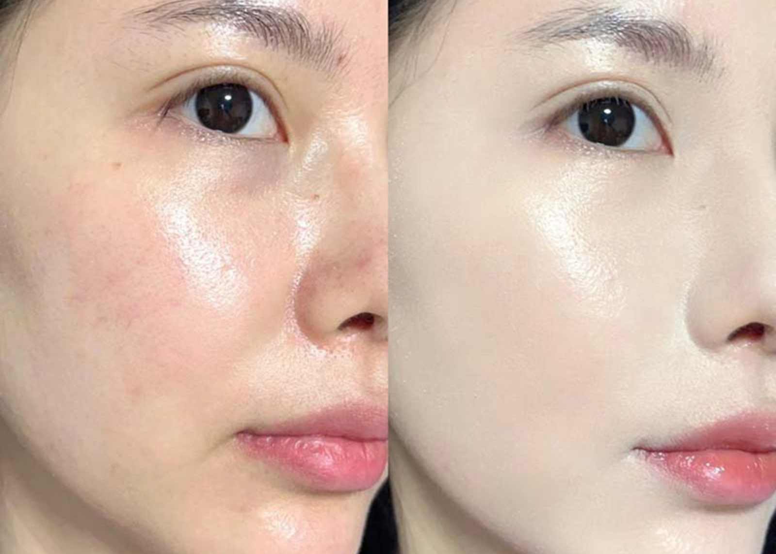 cách dưỡng trắng da mặt