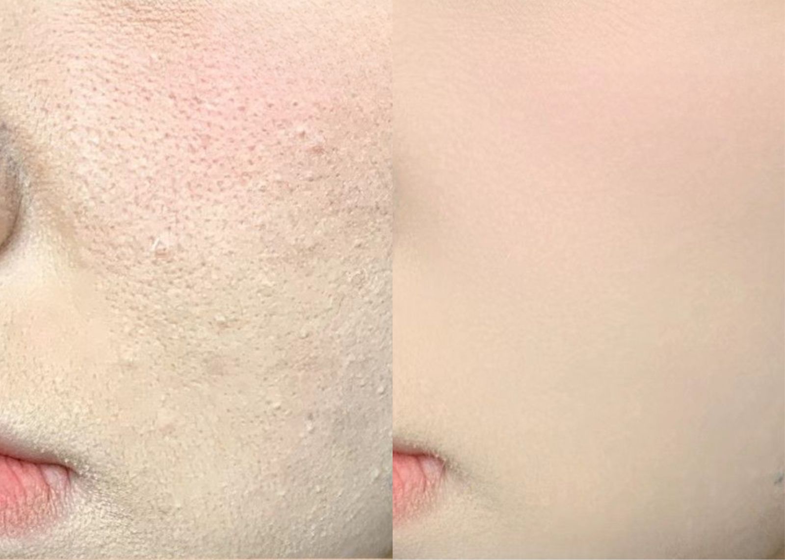 cách đánh nền không bị mốc