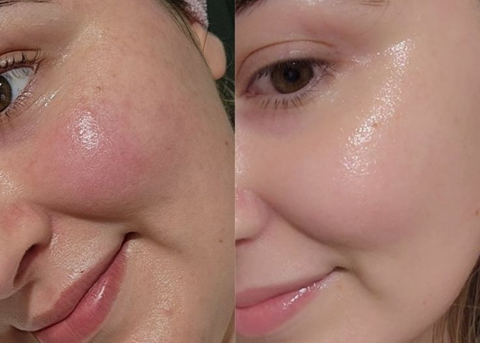 dưỡng sáng da mặt