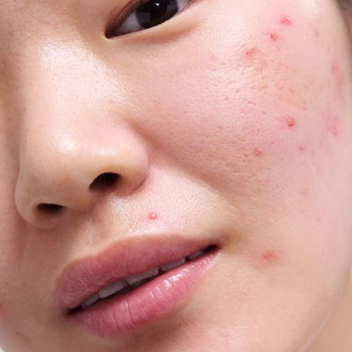 các bước skincare