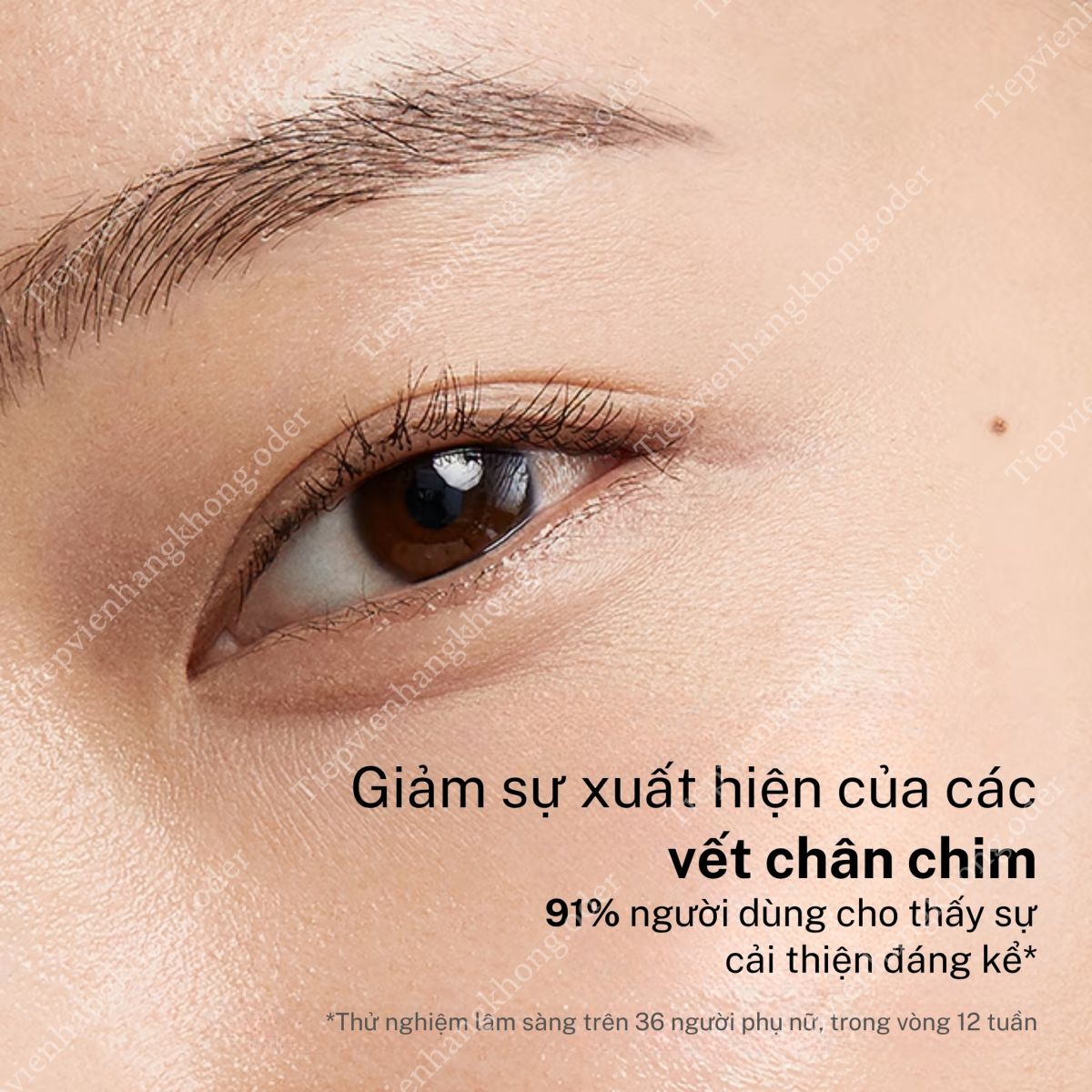 giảm thâm mắt
