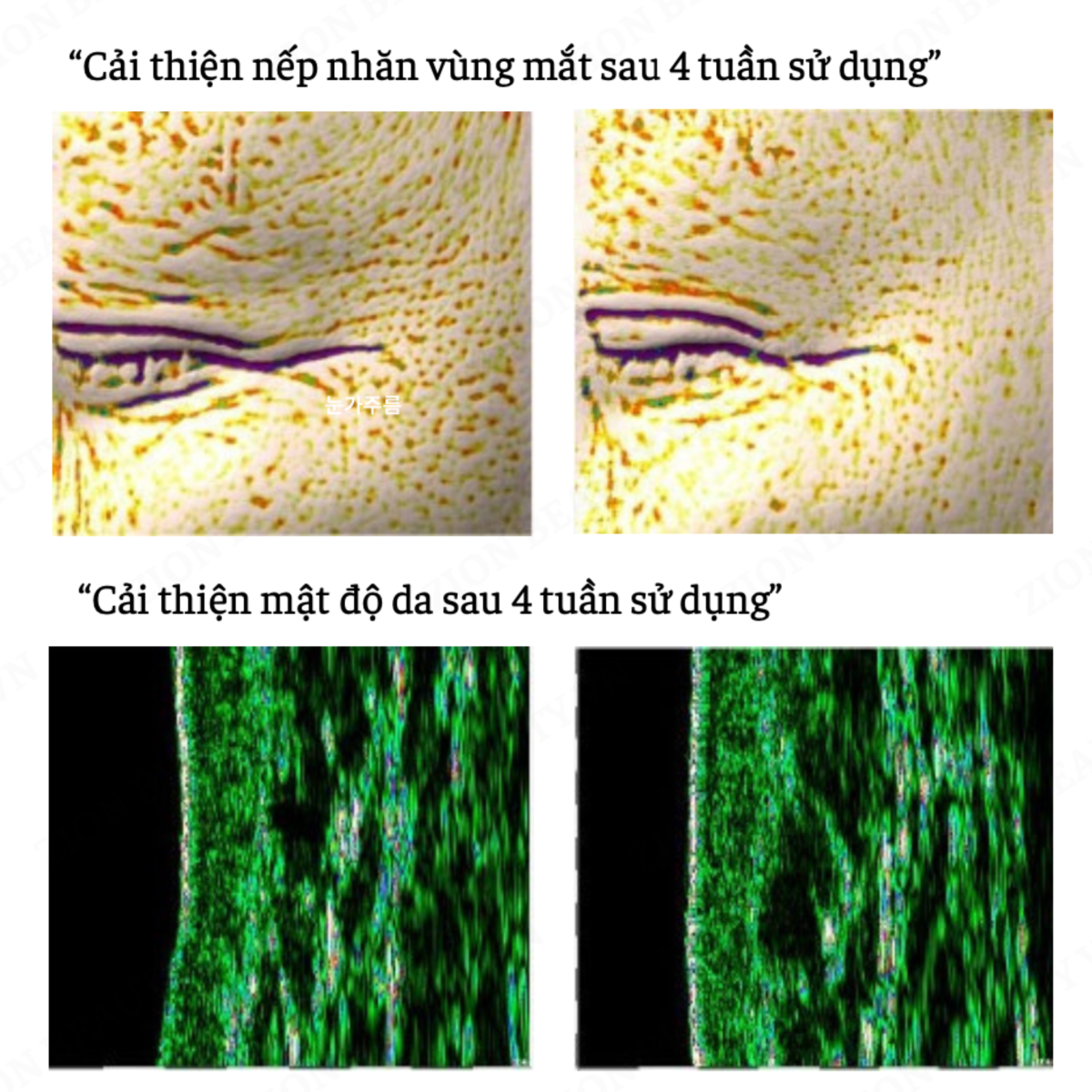 chăm sóc da mặt